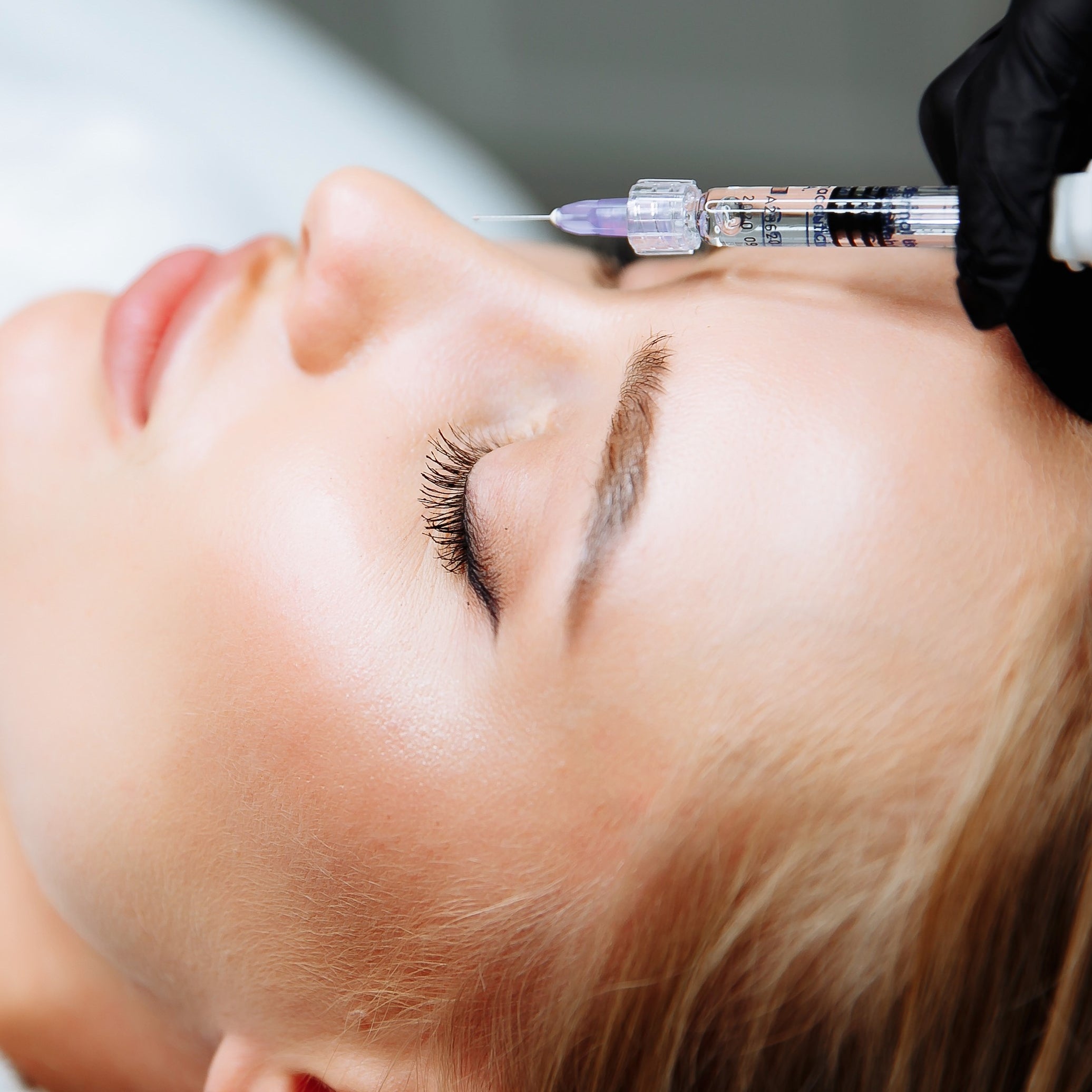 Bunny Lines Botulinum Toxin Treatment — Skinview Medical Aesthetics