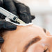 Skinview Botox Treatment