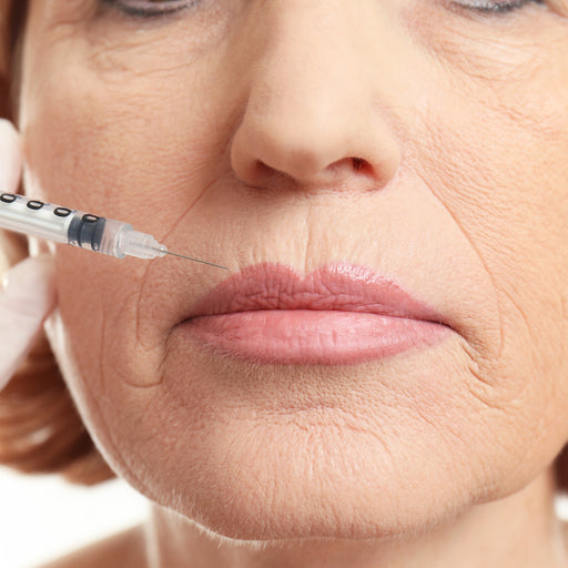Skinview Botox Treatments